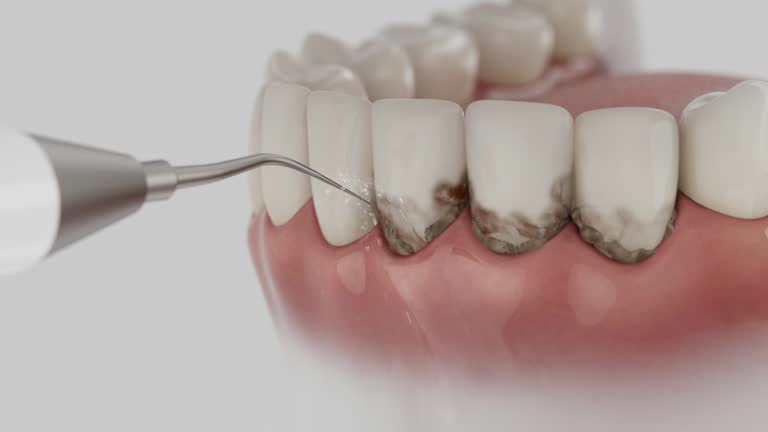 Reliable Tooth Extraction contractor in Andrews, IN by Smile Center Dentistry